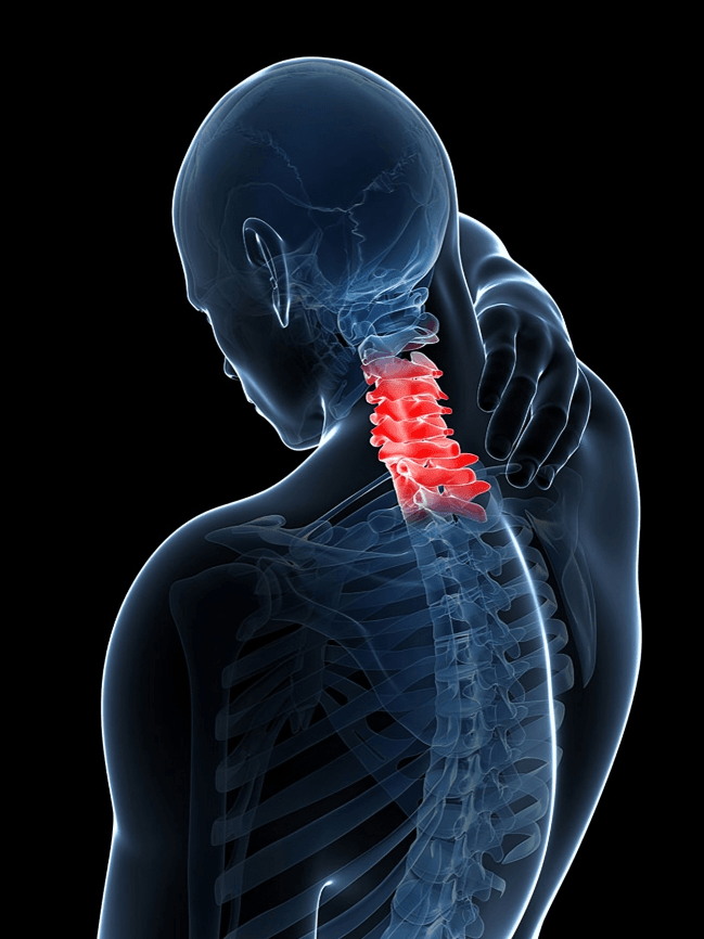 Medical scan highlighting painful cervical spine in a human.