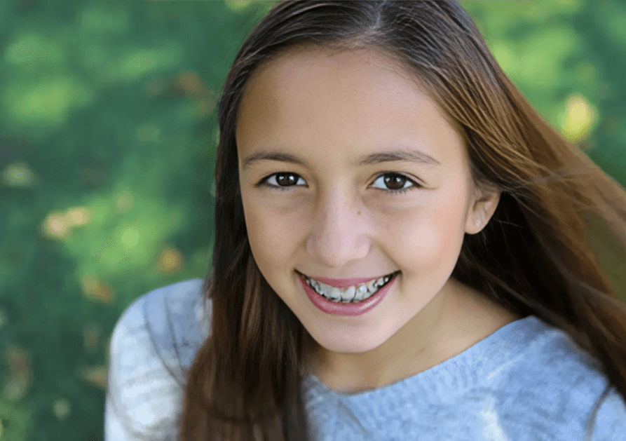 Smiling girl with braces on teeth looking up.