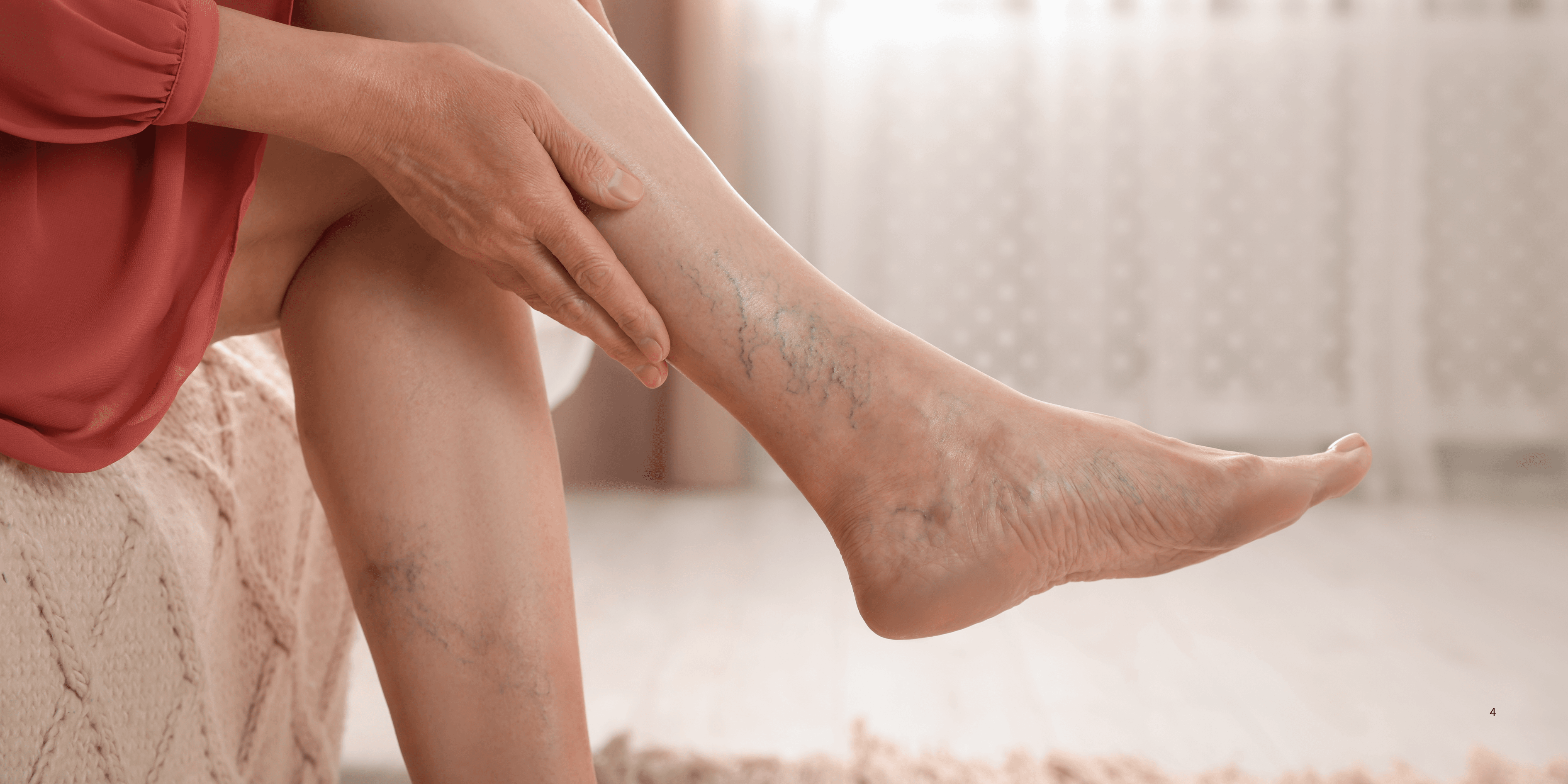 A person's hand touches a leg with visible varicose veins.