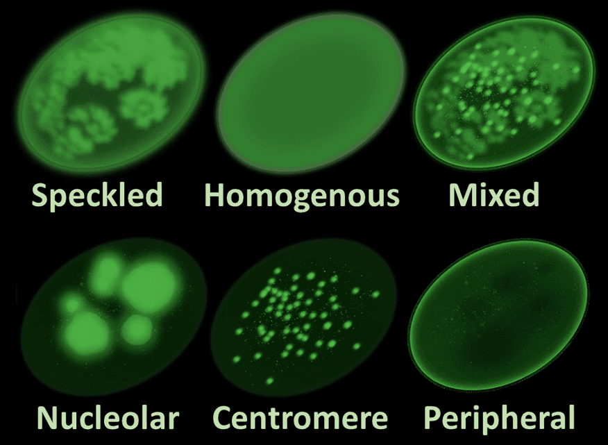 Six oval shapes showing different immunofluorescence staining patterns.