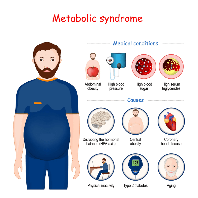 Diagram of metabolic syndrome with a figure and associated conditions.