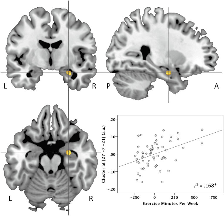 Brain scans and scatter plots showing exercise and brain activity.
