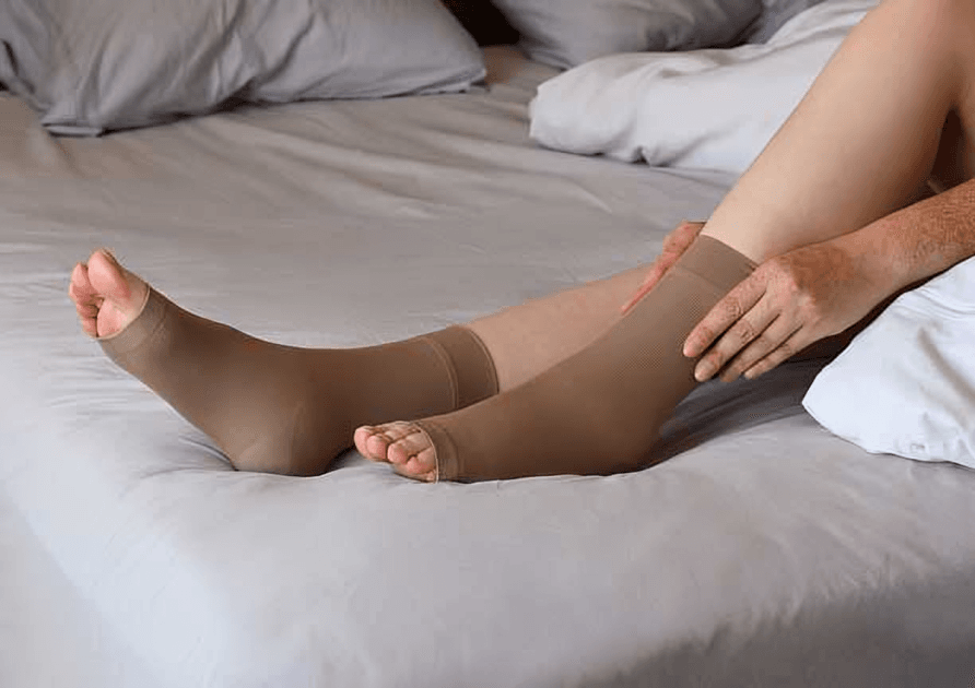 A person putting on compression stockings to treat leg swelling.