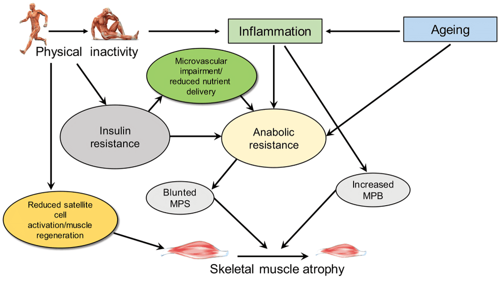 A diagram showing factors contributing to skeletal muscle atrophy.