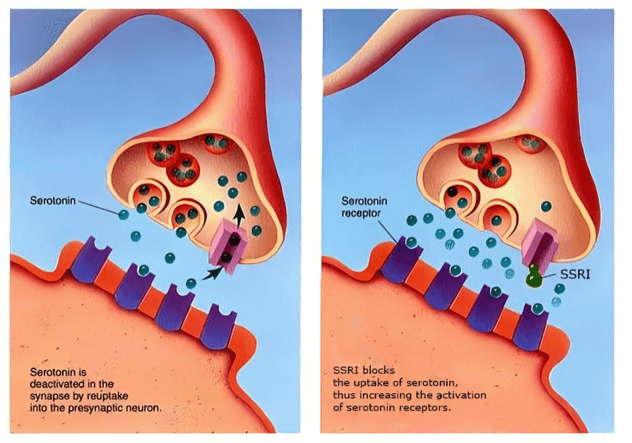 SSRI mechanism: Serotonin reuptake inhibition at the synapse.