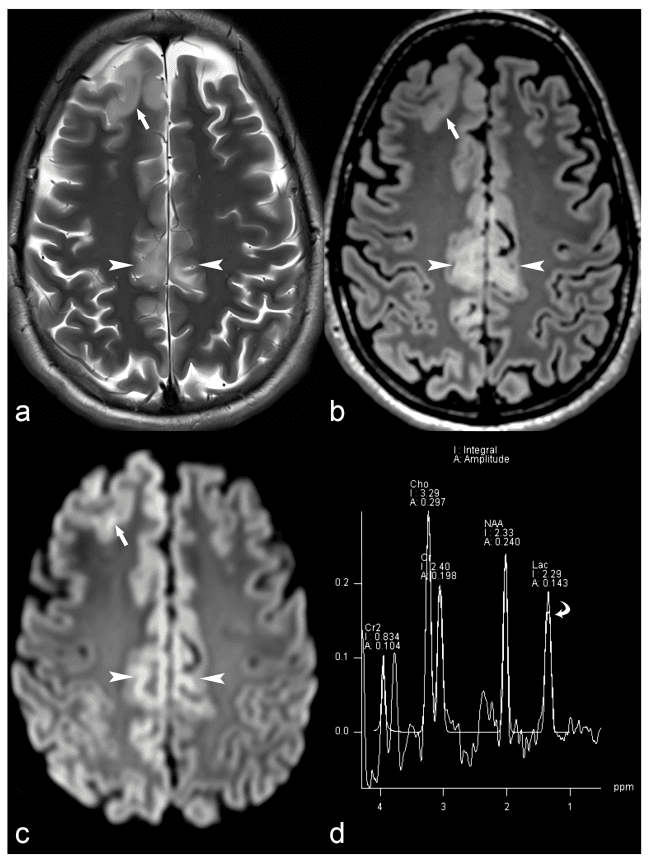 Medical imaging: MRI scans (a, b, c) and a spectrum (d).