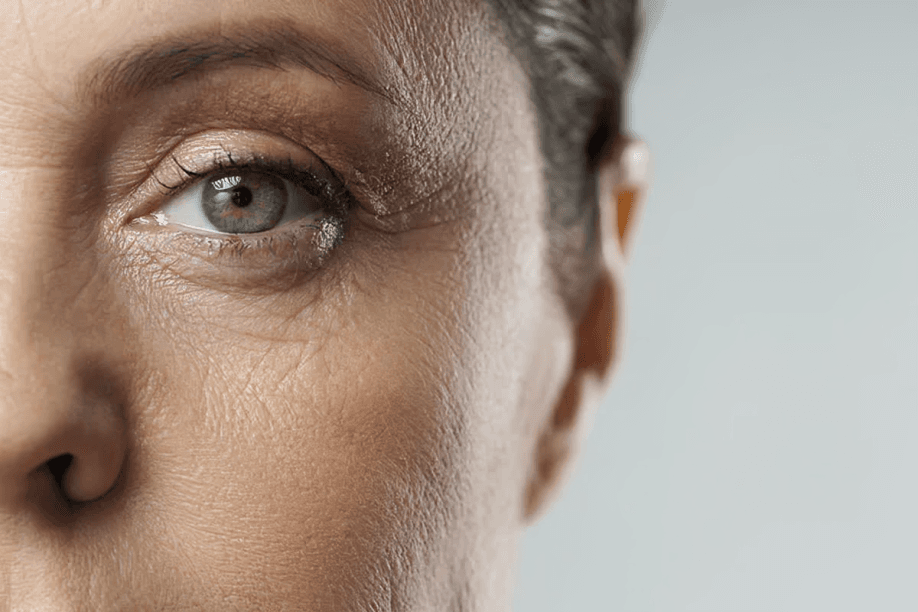 Close-up of a woman's eye with visible wrinkles.