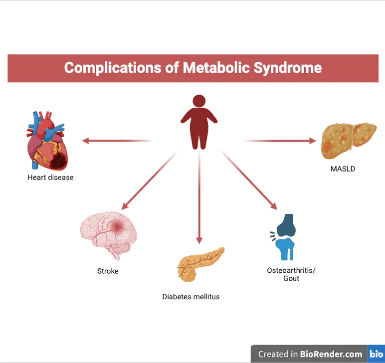 Metabolic syndrome complications: heart disease, stroke, diabetes, liver, and joints.