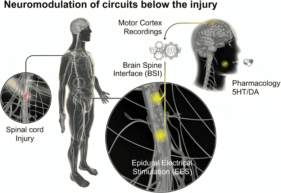 Neuromodulation for spinal cord injury with EES and BSI.
