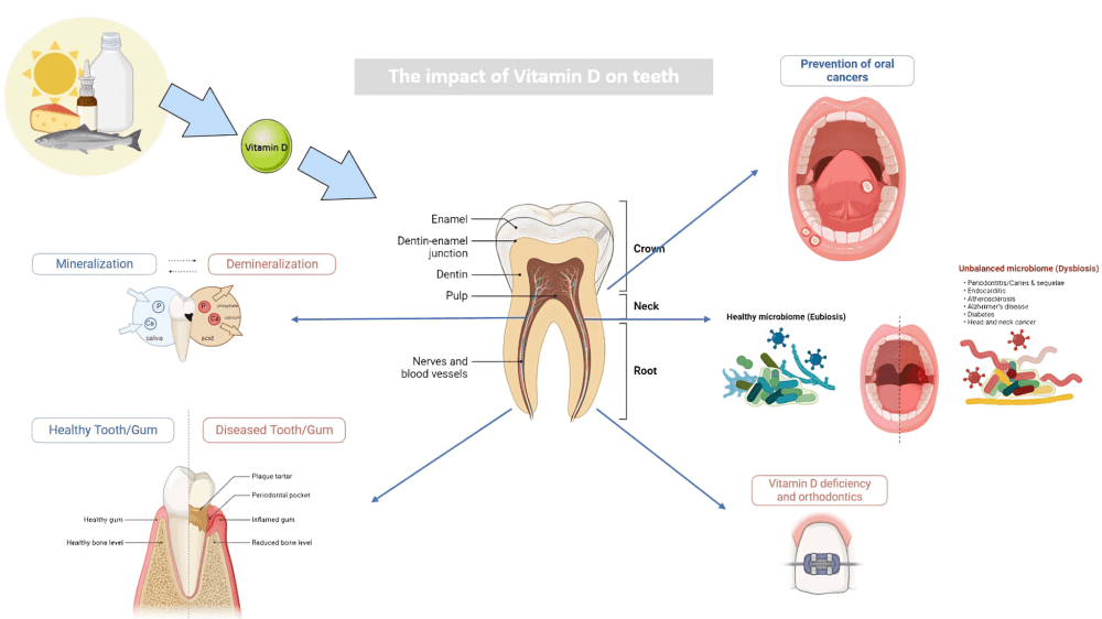 Vitamin D's impact on teeth and oral health.
