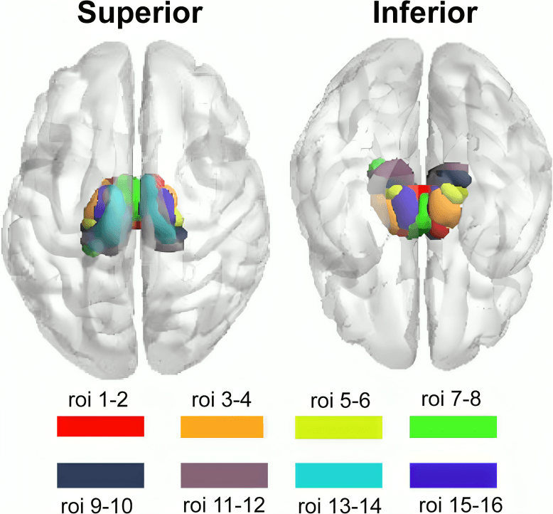 Brain visualizations showing superior and inferior views with colored regions.
