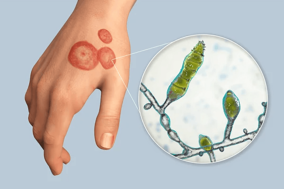 An illustrated hand and magnified fungal hyphae.