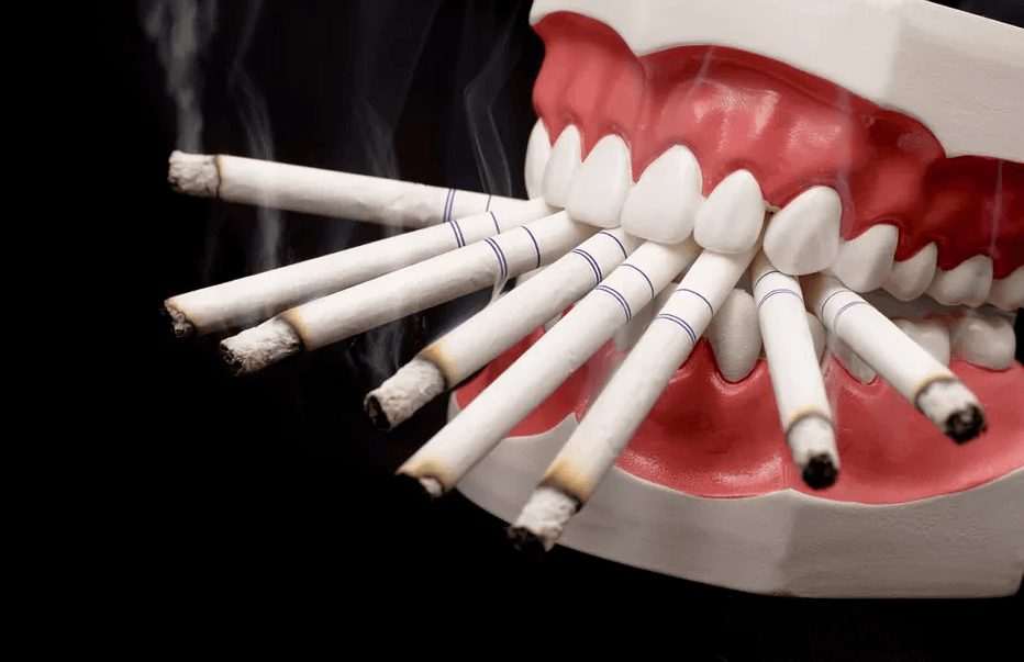Cigarettes in a dental model's mouth, illustrating smoking's effects.