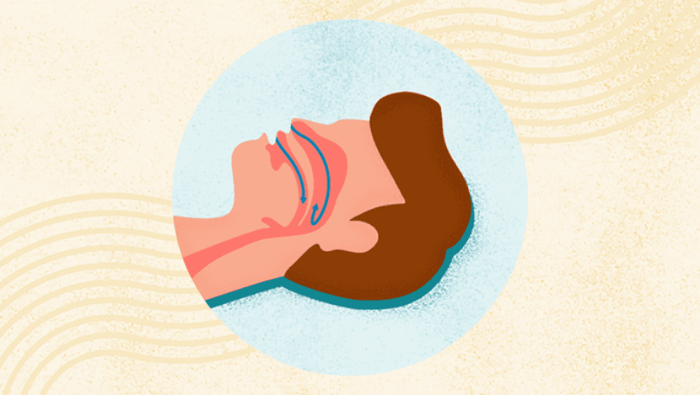 Illustration of a person's head showing a clear airway.