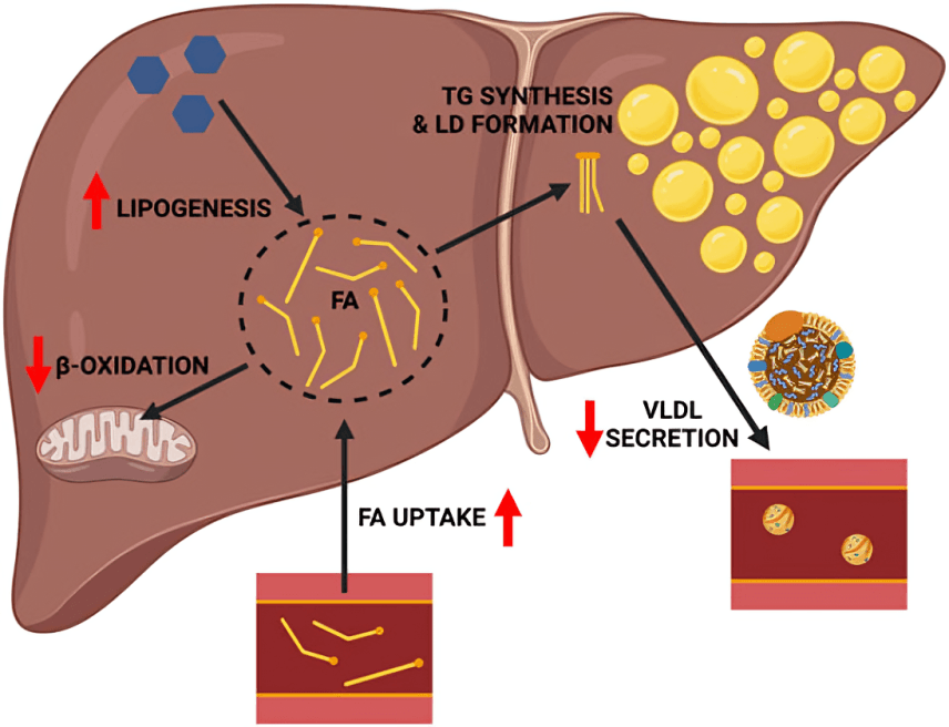 Diagram of liver illustrating mechanisms of fatty liver disease.