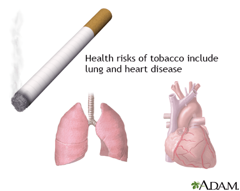 Tobacco health risks: lung and heart disease illustration.