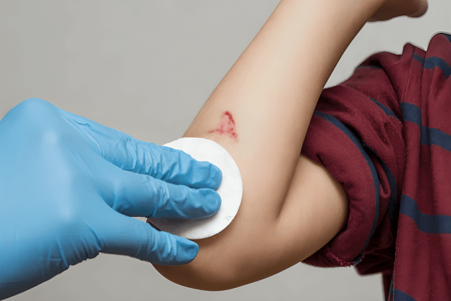 A doctor’s hand cleaning an injured arm.