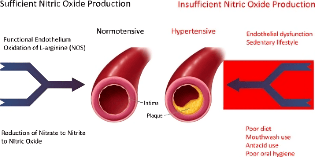 Nitric oxide production: sufficient vs. insufficient, affecting blood vessels.