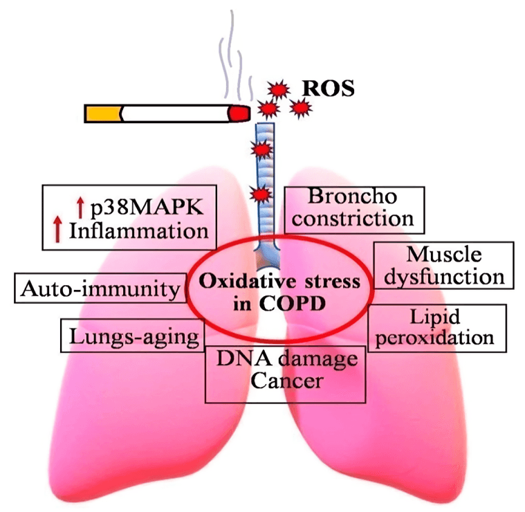COPD diagram with cigarette, lungs, and labeled symptoms and effects.