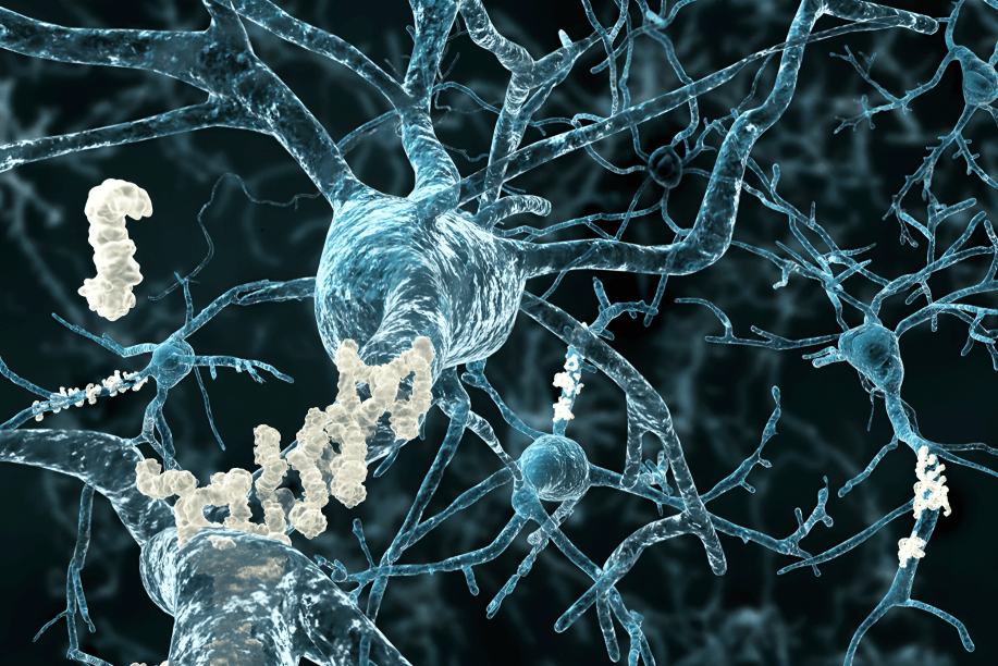 3D rendering of neurons with amyloid plaques.