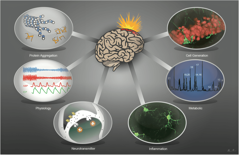 Multiple factors influence brain health and function.